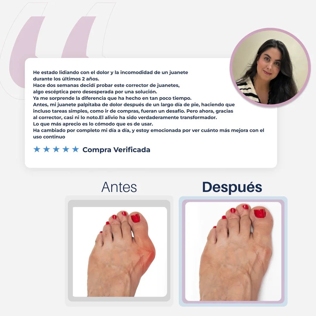 AliviFlex™️ – Acelera la alineación de tus juanetes mientras duermes