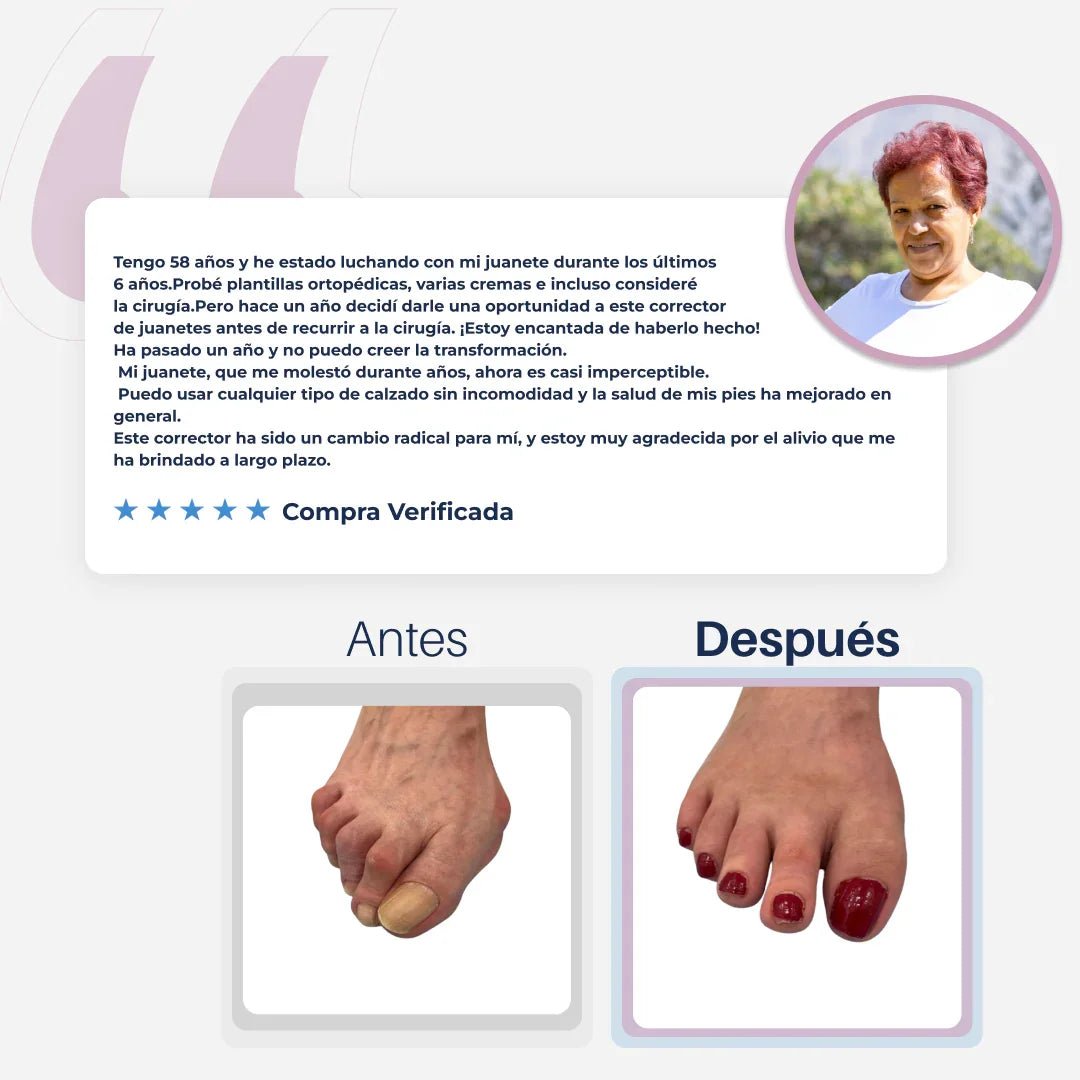 AliviFlex™️ – Acelera la alineación de tus juanetes mientras duermes